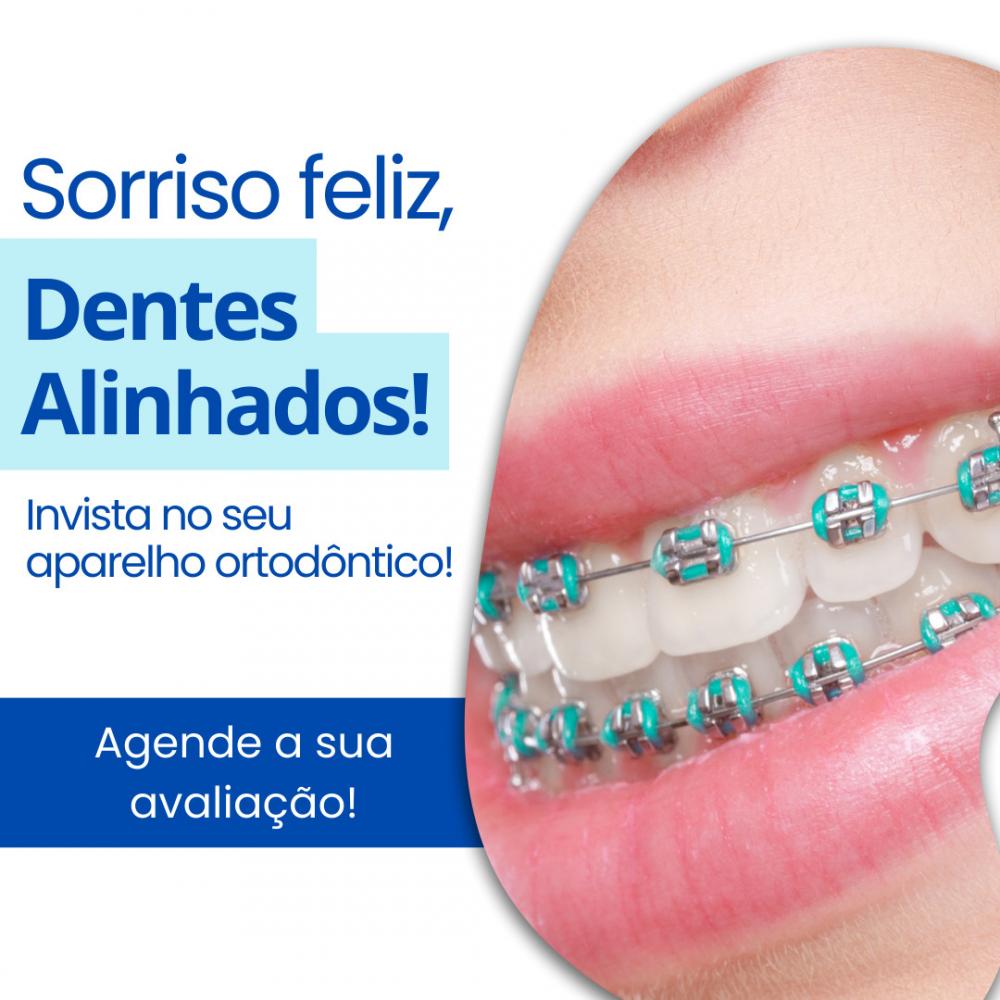 OrthoDontic Clínica Odontológica em Santos, Aparelho Estético